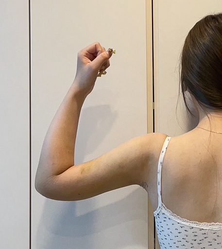 二の腕の脂肪吸引