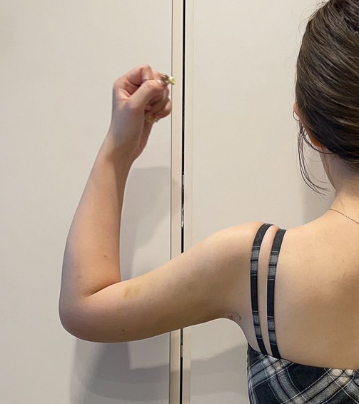 二の腕の脂肪吸引