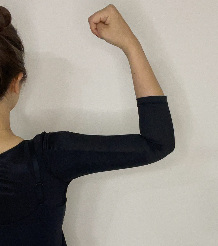 二の腕の脂肪吸引