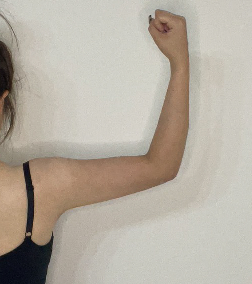 二の腕の脂肪吸引