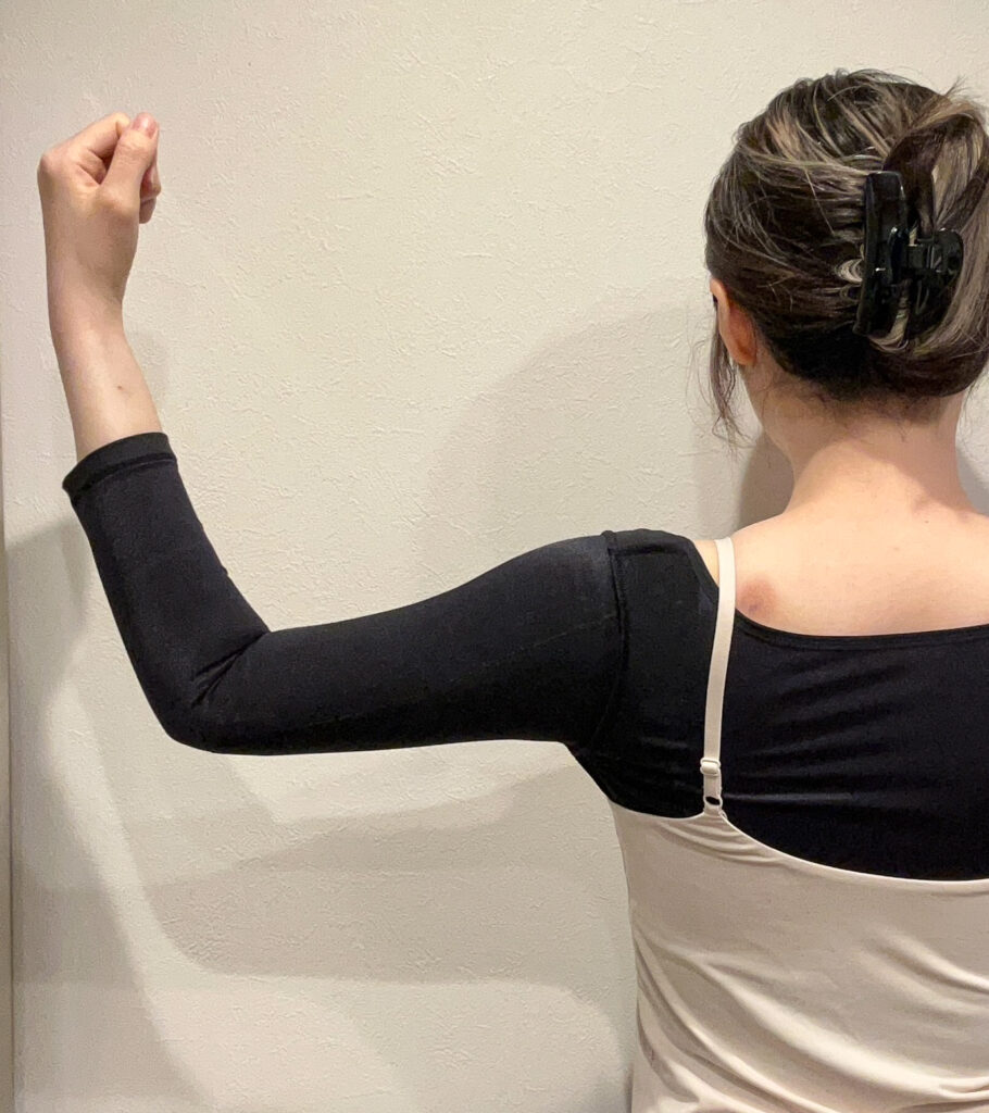 二の腕の脂肪吸引