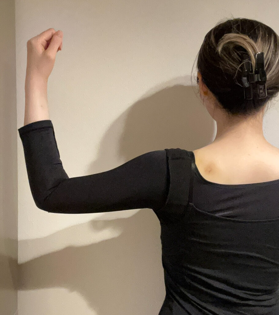 二の腕の脂肪吸引