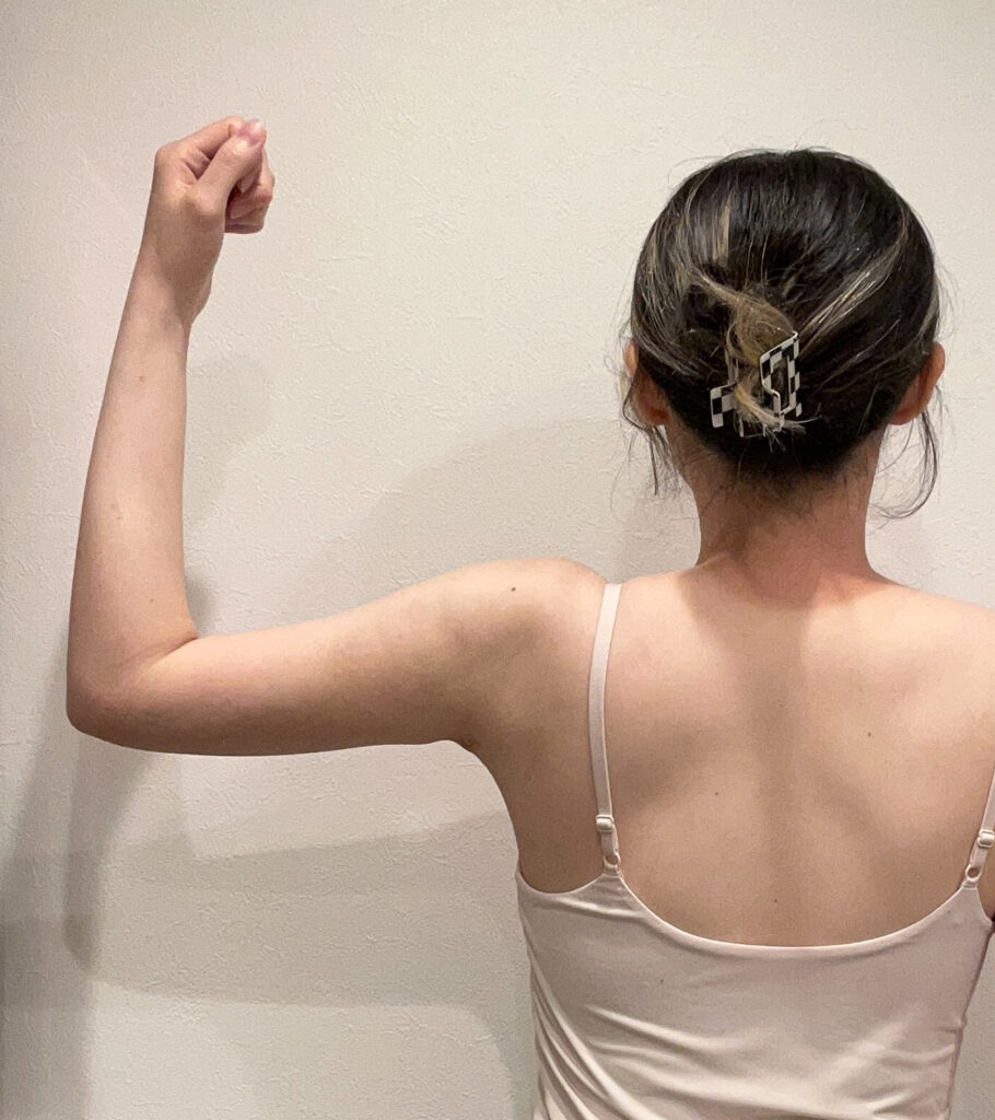 二の腕の脂肪吸引