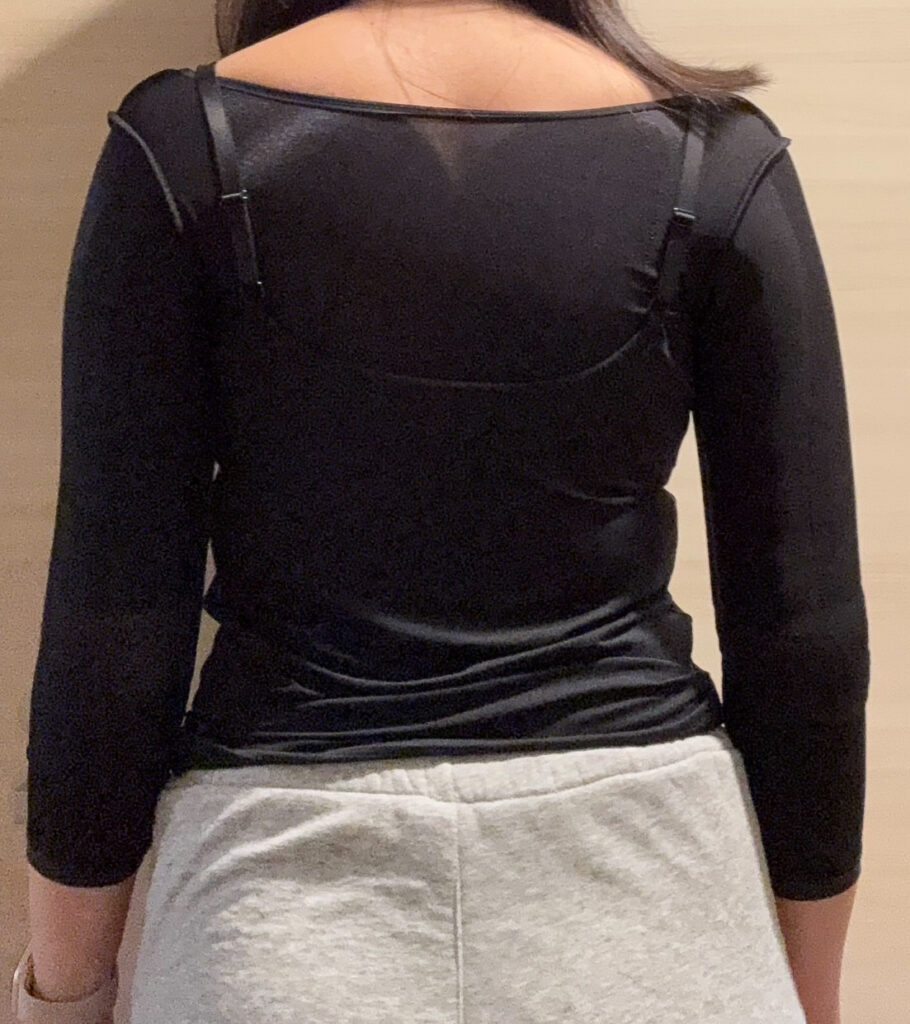 二の腕の脂肪吸引