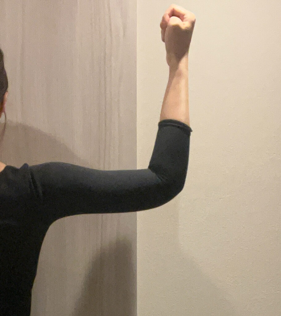 二の腕の脂肪吸引