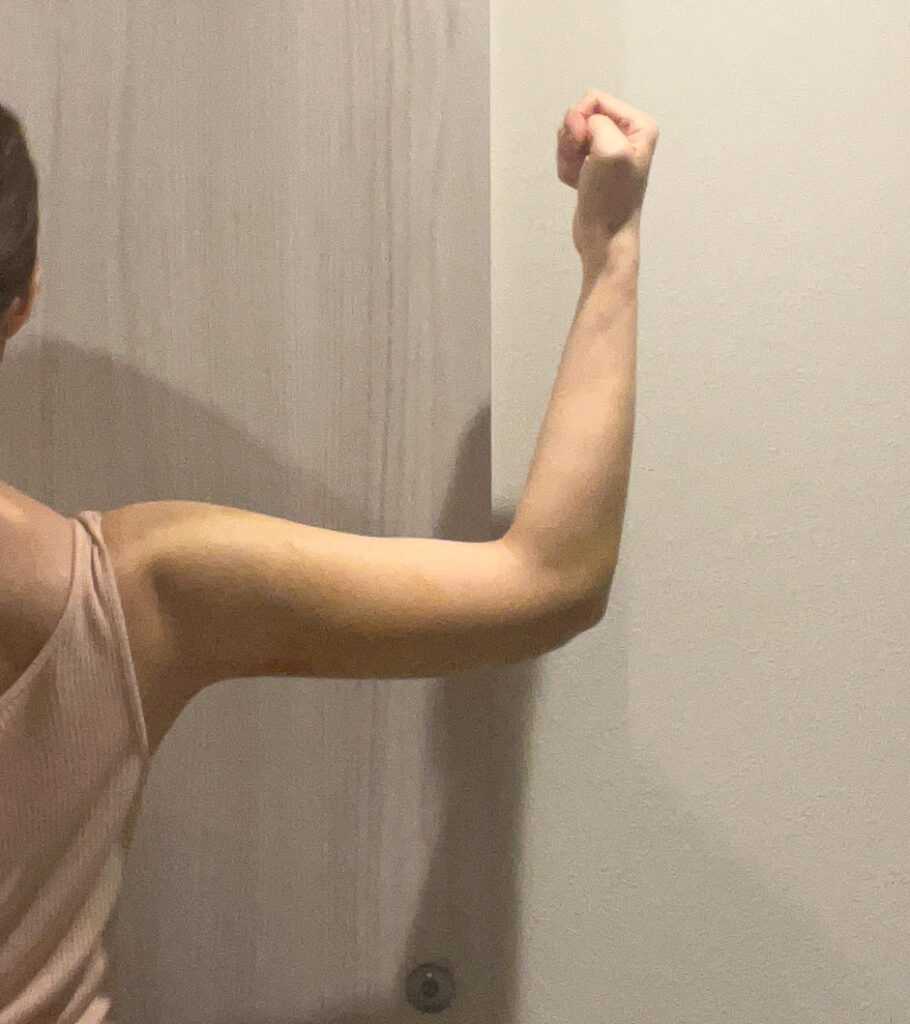 二の腕の脂肪吸引