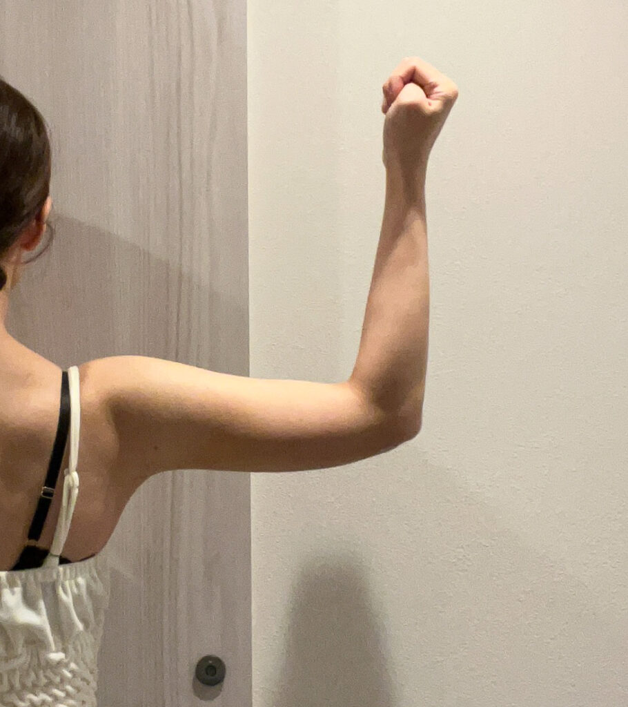 二の腕の脂肪吸引