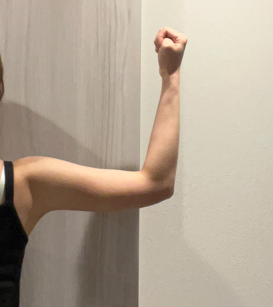 二の腕の脂肪吸引