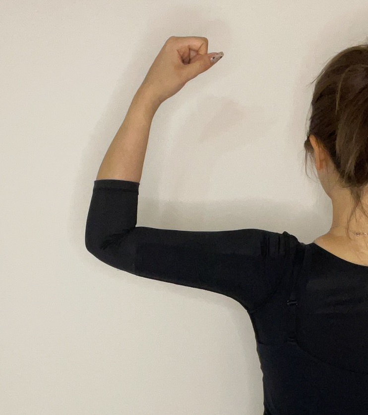 二の腕の脂肪吸引