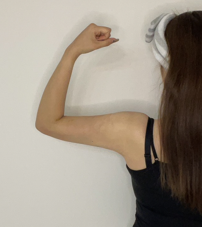 二の腕の脂肪吸引