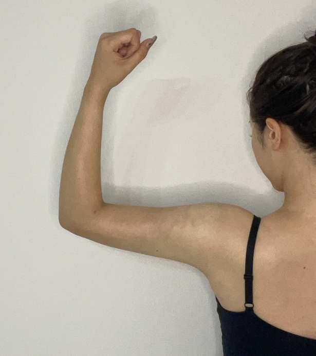 二の腕の脂肪吸引