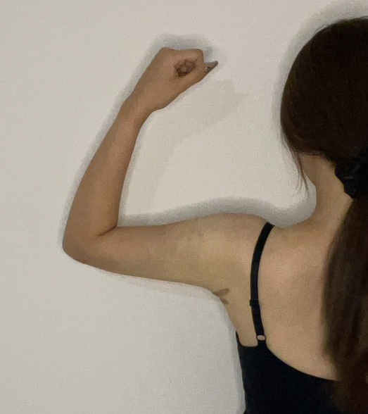 二の腕の脂肪吸引