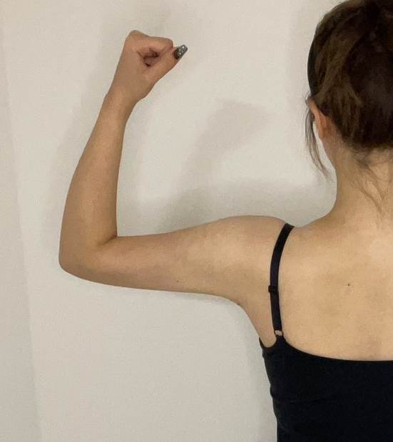 二の腕の脂肪吸引