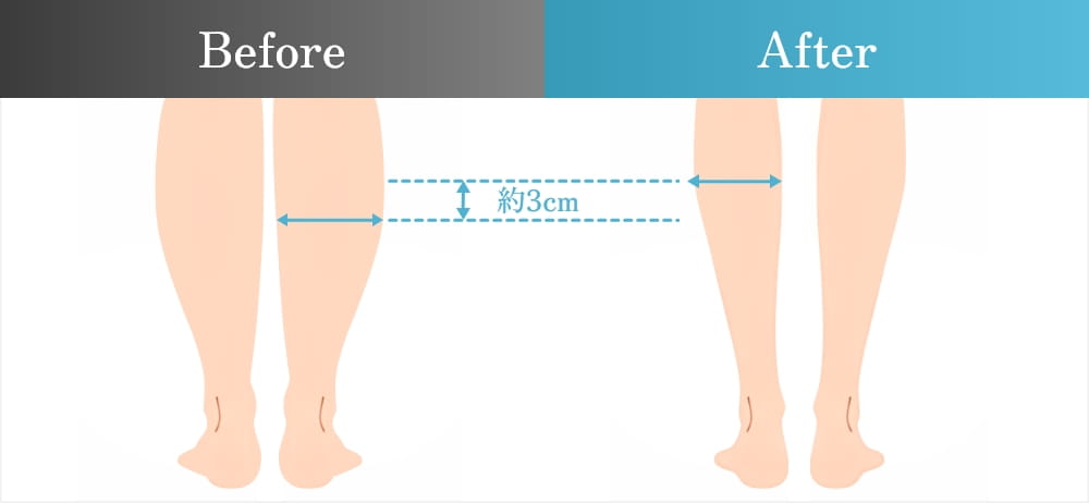 ふくらはぎのふくらみ部分の前後の比較
