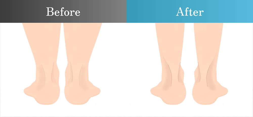 足元のビフォーアフター