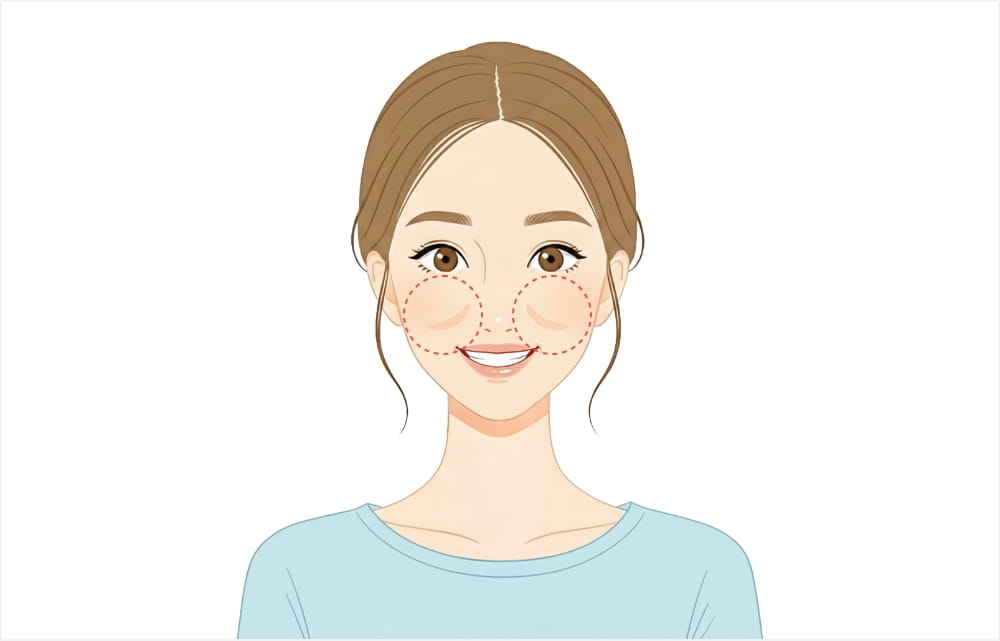 メーラーファットが発達している人