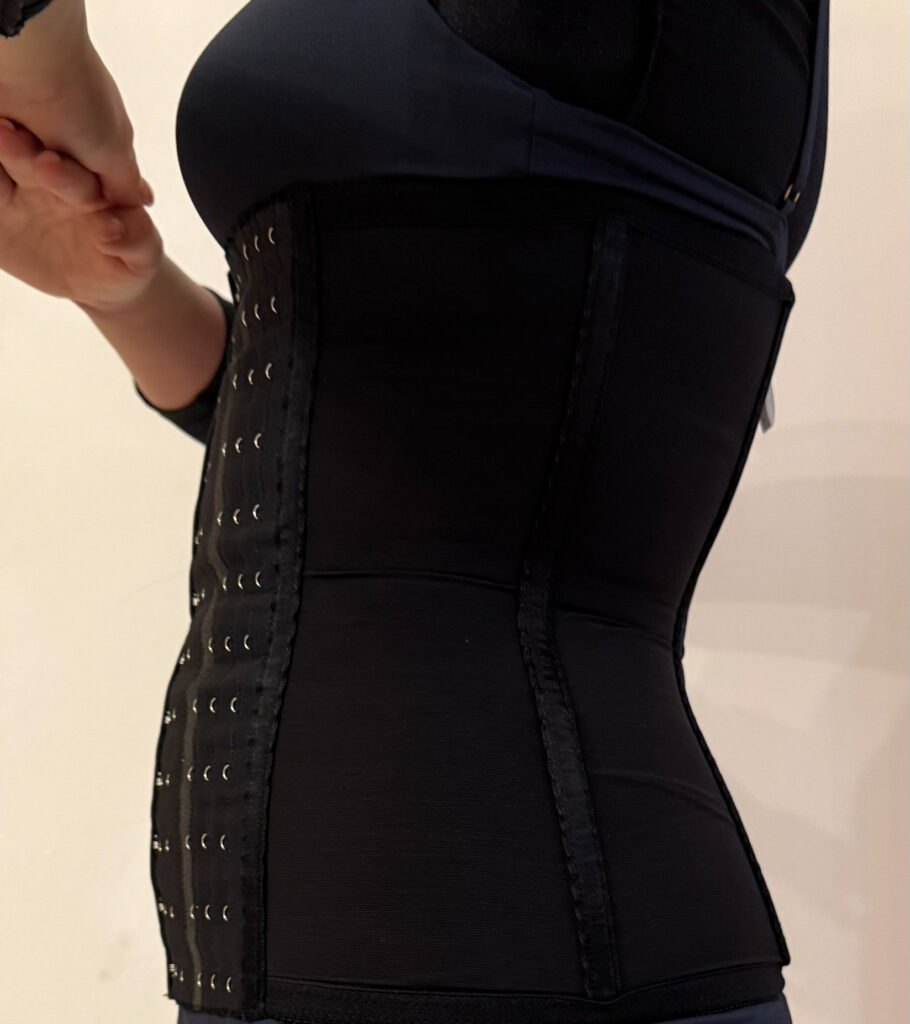 お腹の脂肪吸引