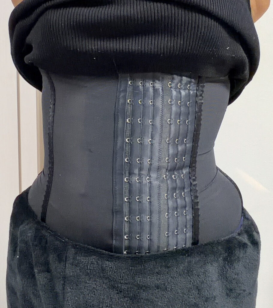 お腹の脂肪吸引