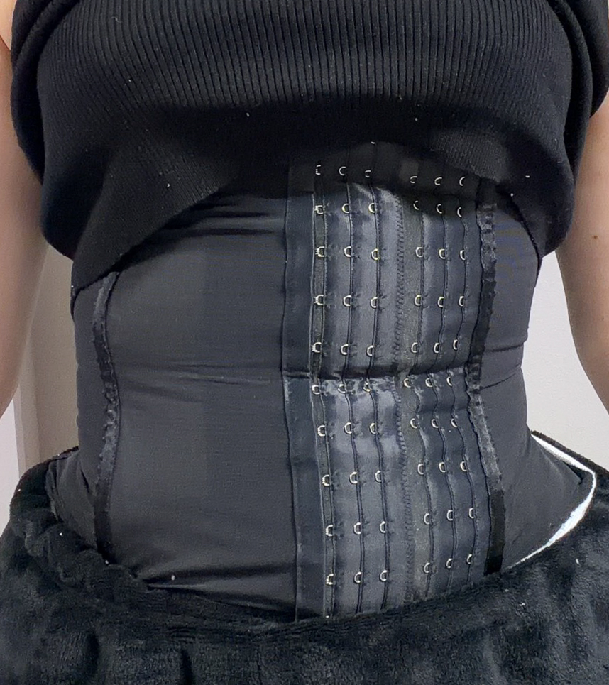 お腹の脂肪吸引