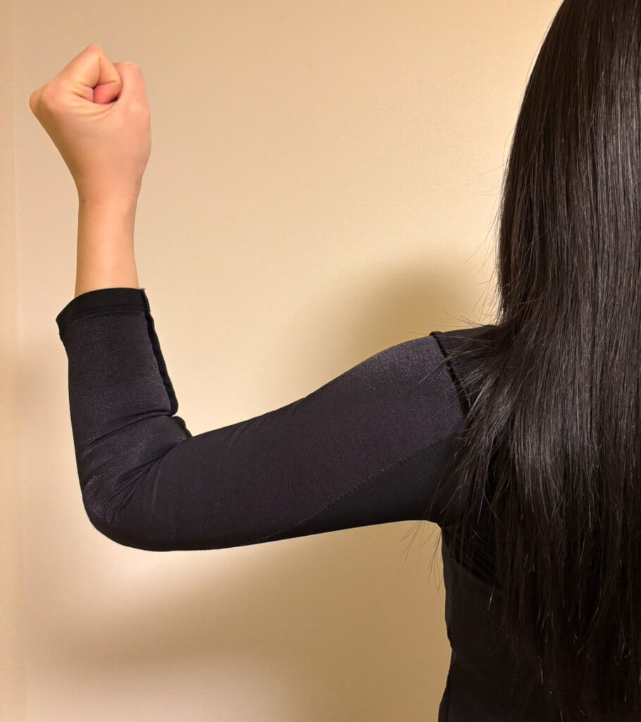 二の腕の脂肪吸引