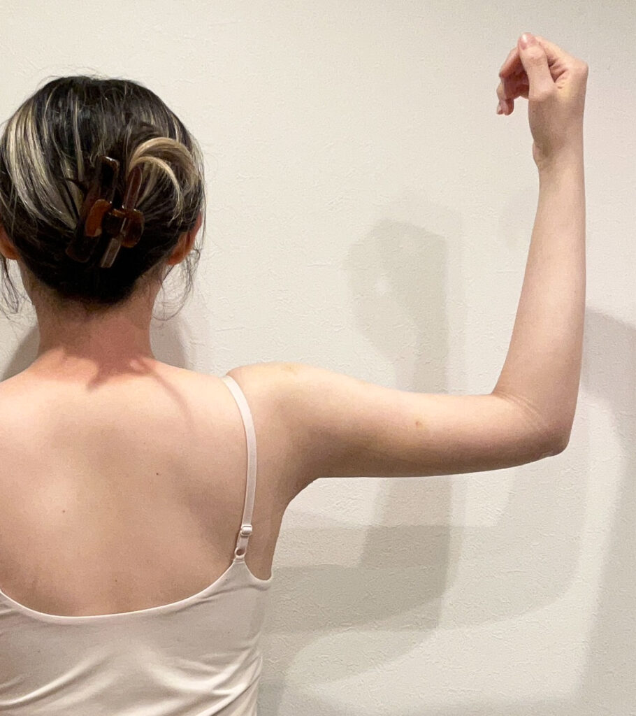 二の腕の脂肪吸引