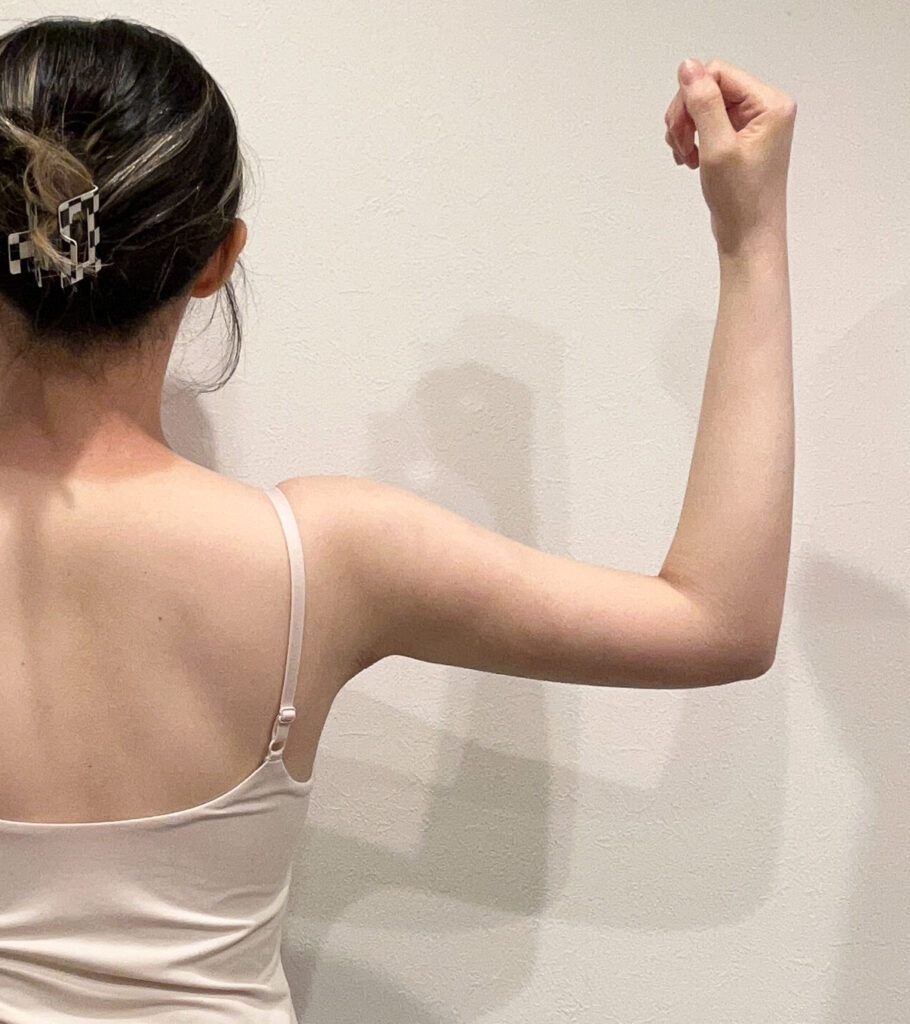 二の腕の脂肪吸引