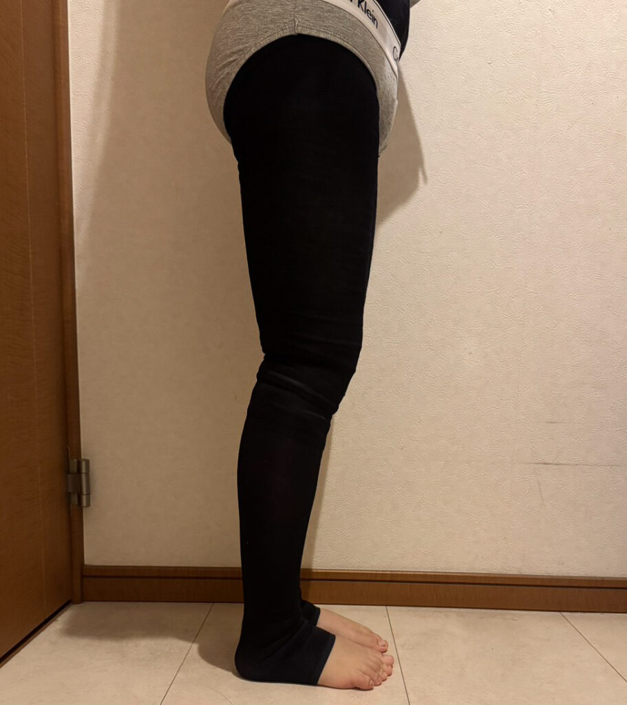 足の脂肪吸引