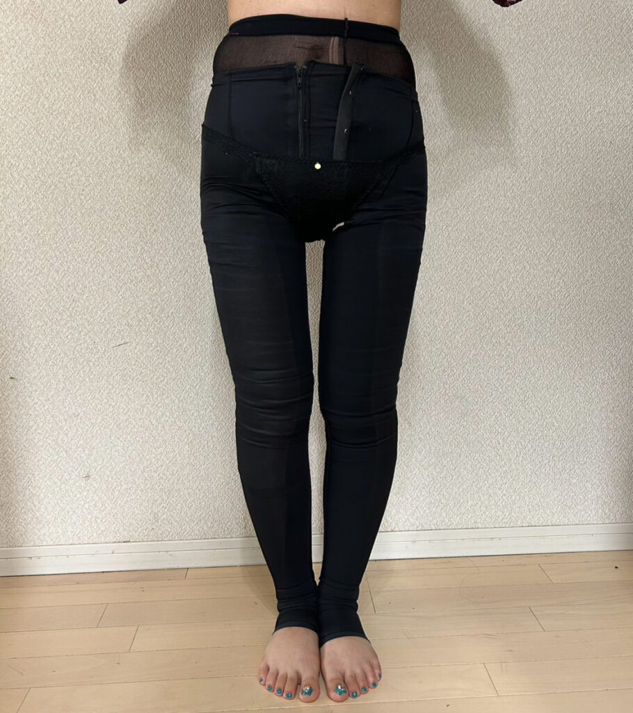 足の脂肪吸引