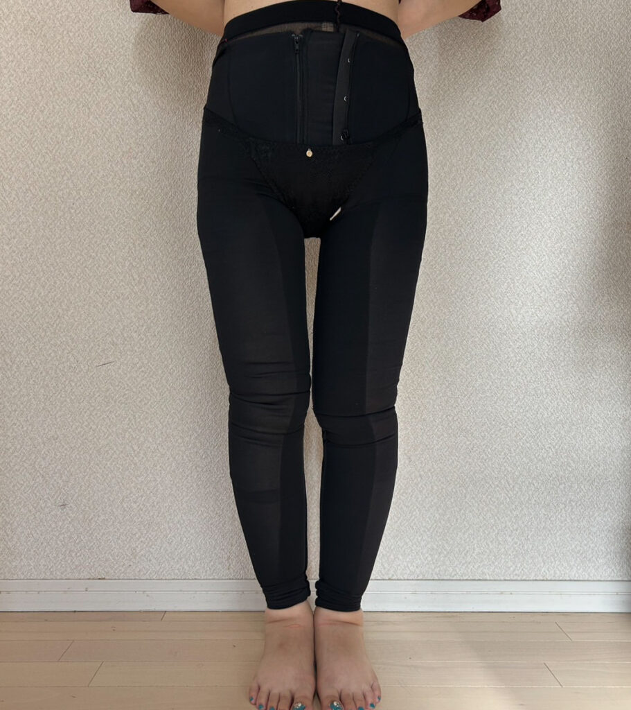 足の脂肪吸引