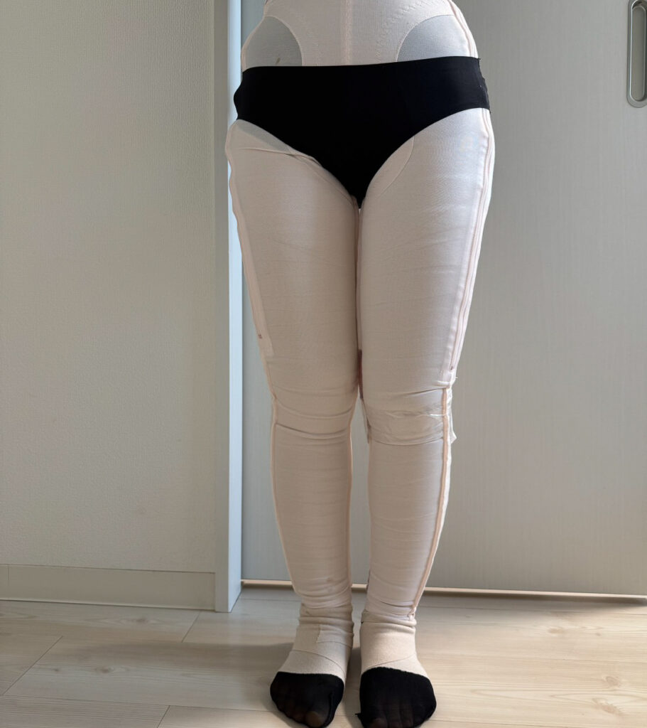 脂肪豊胸