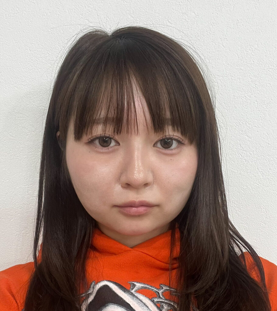顔の脂肪吸引