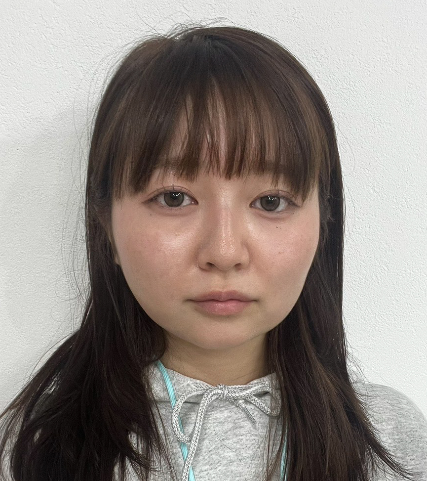 顔の脂肪吸引