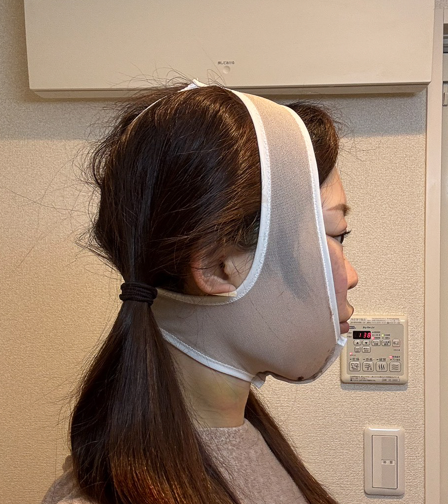 顔の脂肪吸引
