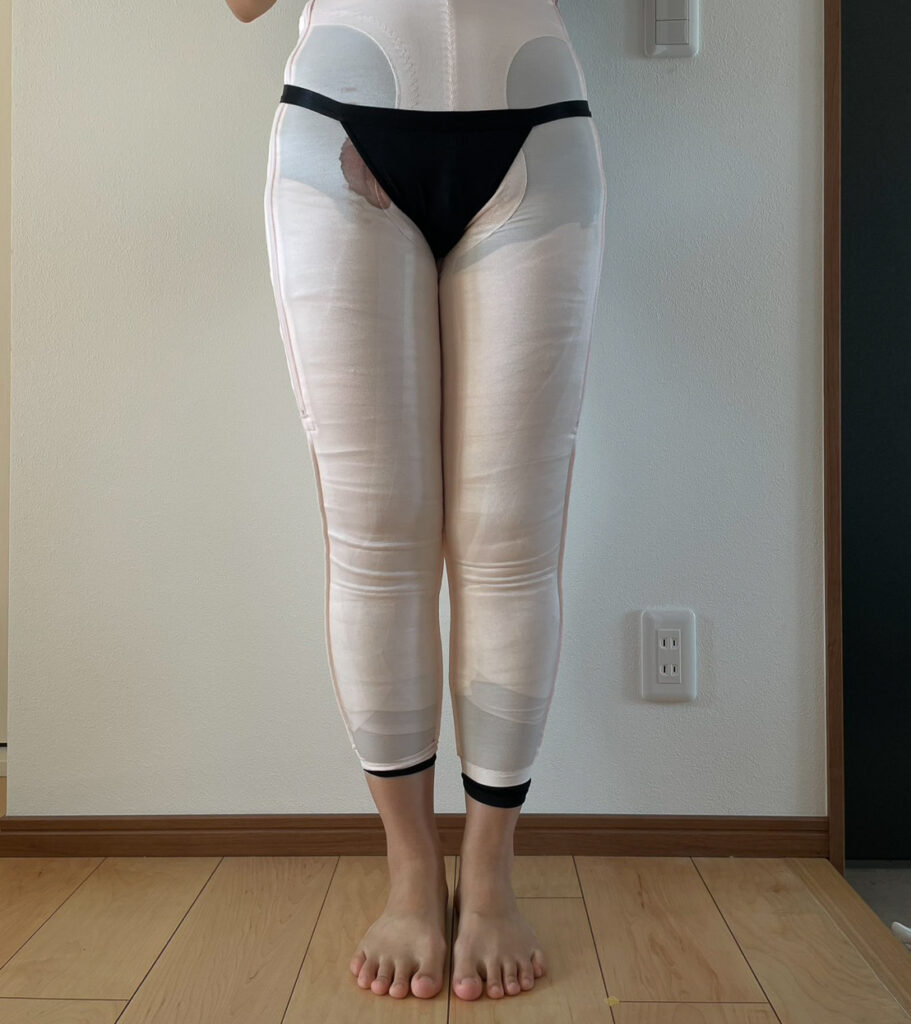 足の脂肪吸引