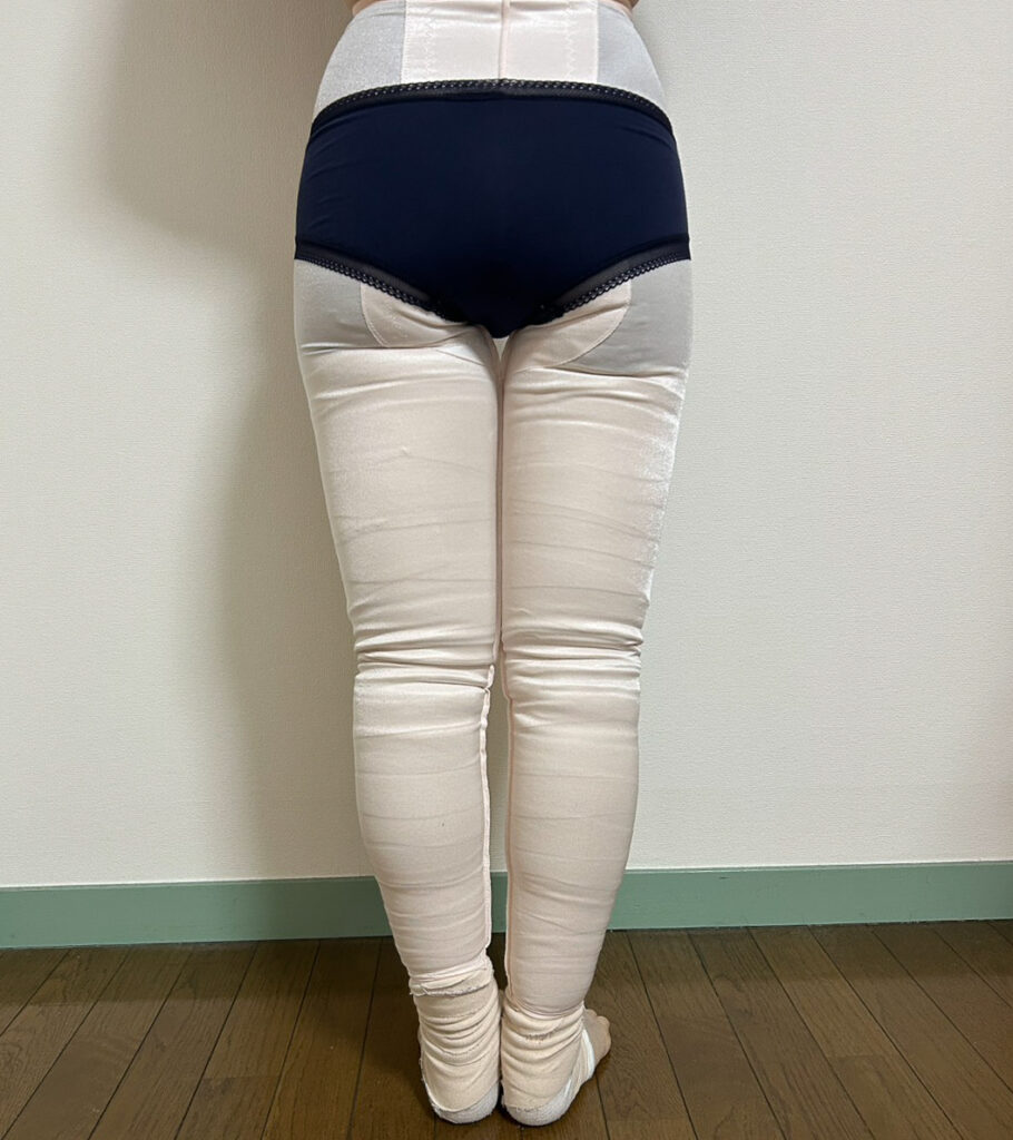 足の脂肪吸引