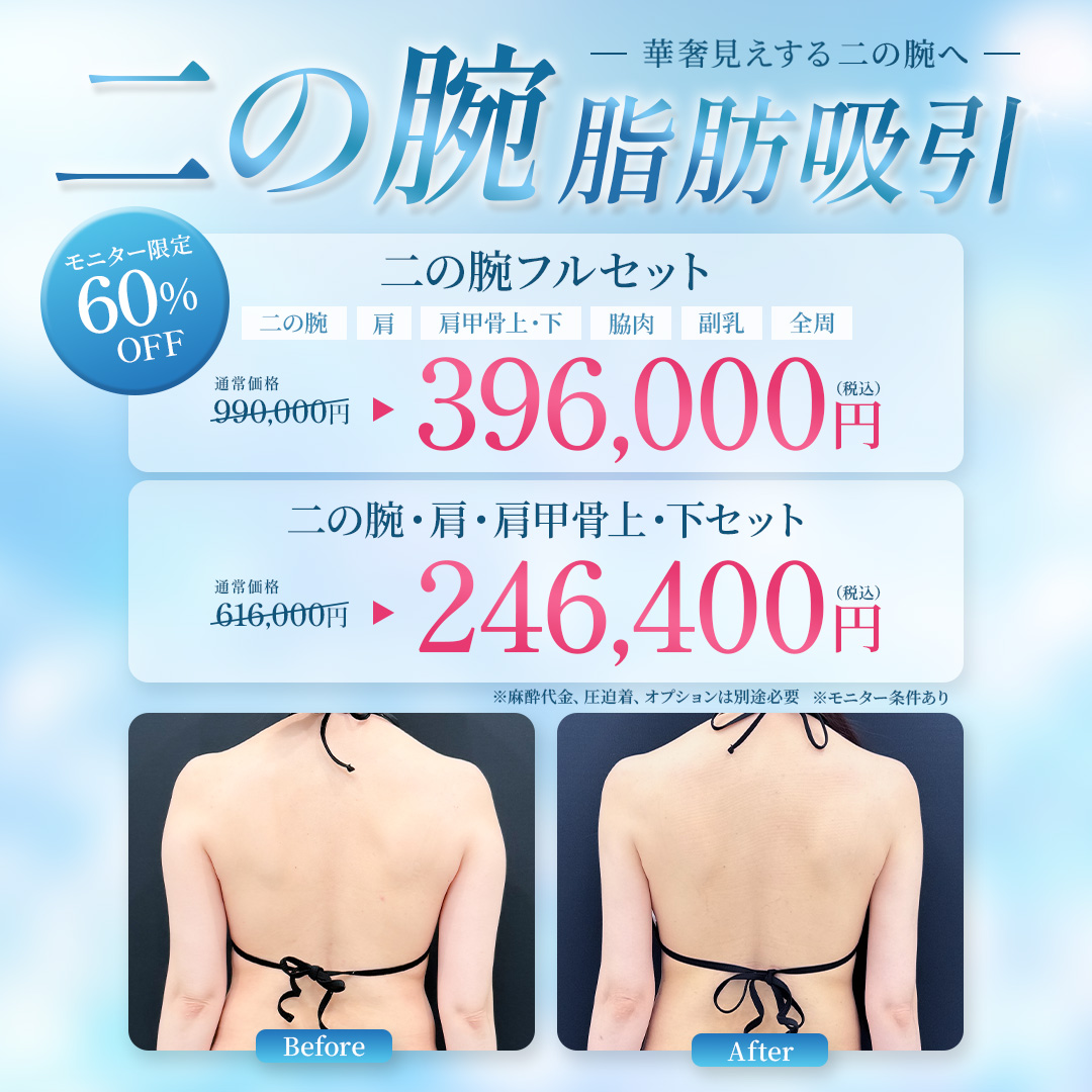 二の腕の脂肪吸引
