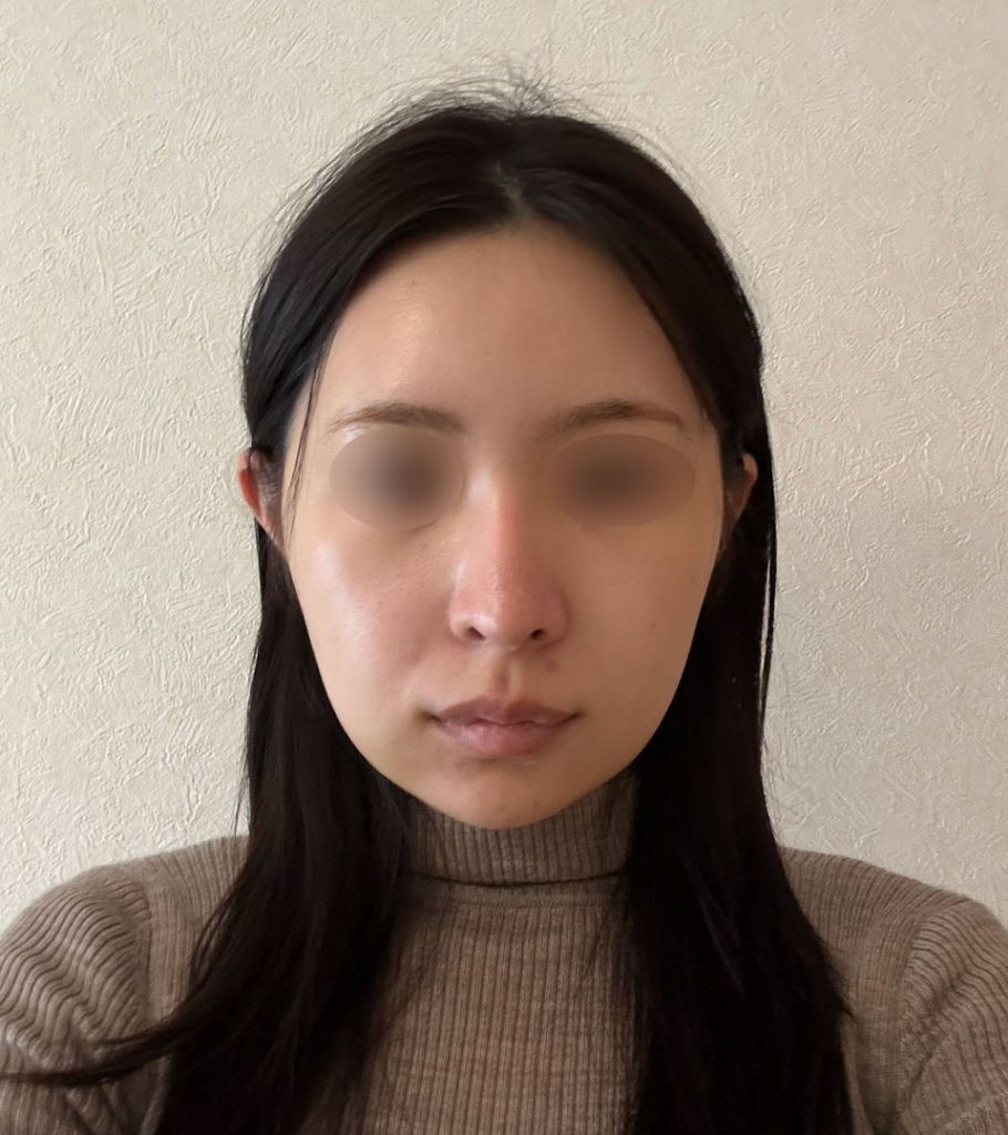 ■術後14日目の症例写真
