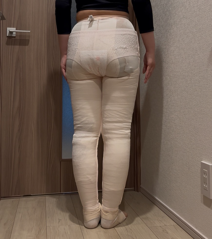 足の脂肪吸引