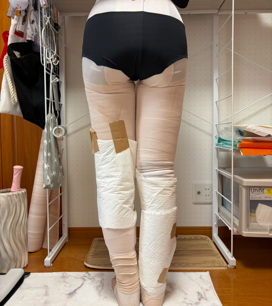 足の脂肪吸引